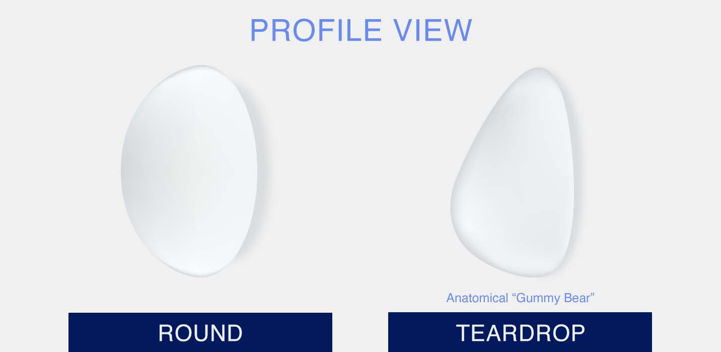 Profile view of round and teardrop breast implant