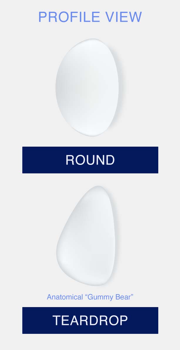 Profile view of round and teardrop breast implant
