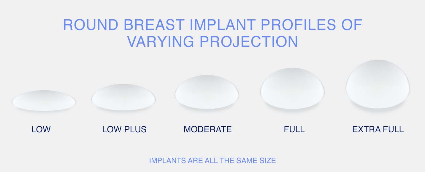Round breast implant profiles of varying projection