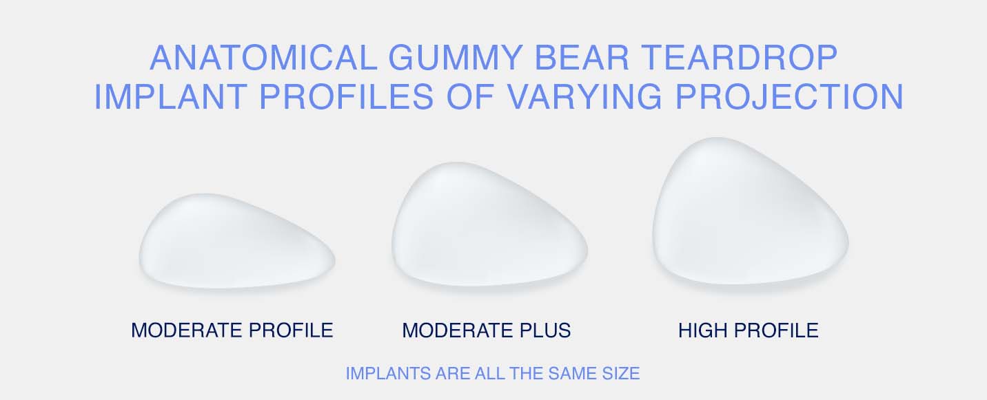 Anatomical gummy bear teardrop implant profiles of varying projection.