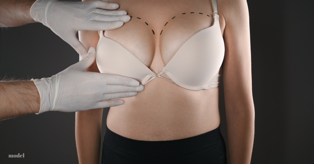 doctor holding patient's breasts for procedure (model)